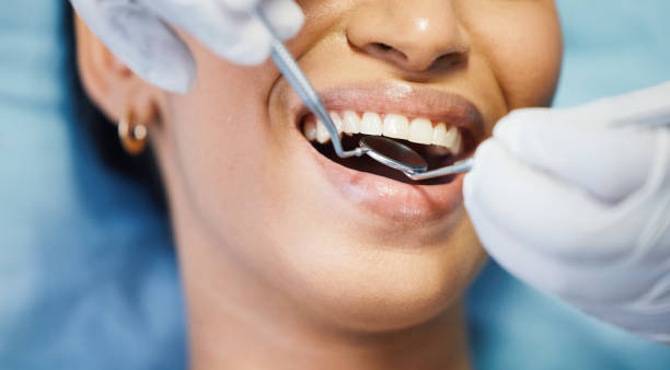 Best Emergency Wisdom Teeth Removal in Fremont, IN